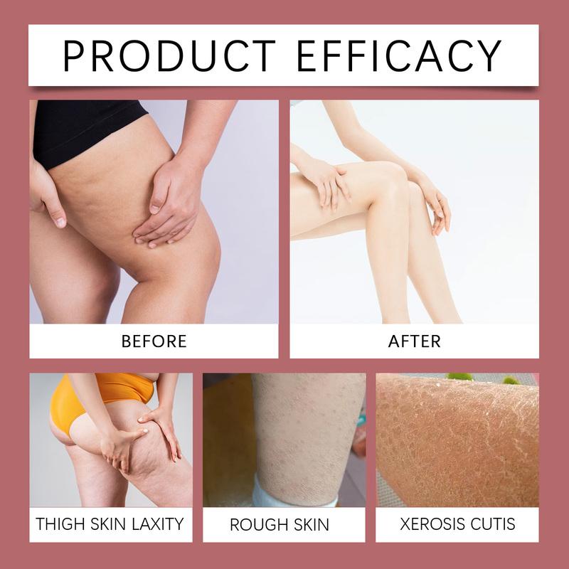 SOUTH MOON Leg Relief Massage Cream 20g Lymphatic Swell Care Foot Edema Swollen Legs Ankles Circulation Body Health Care