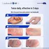 Layanana Potassium Permanganate Foot Treatment Solution