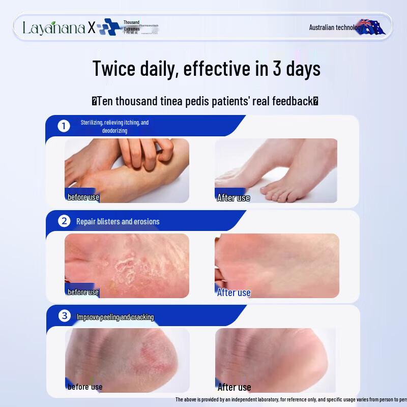 Layanana Potassium Permanganate Foot Treatment Solution