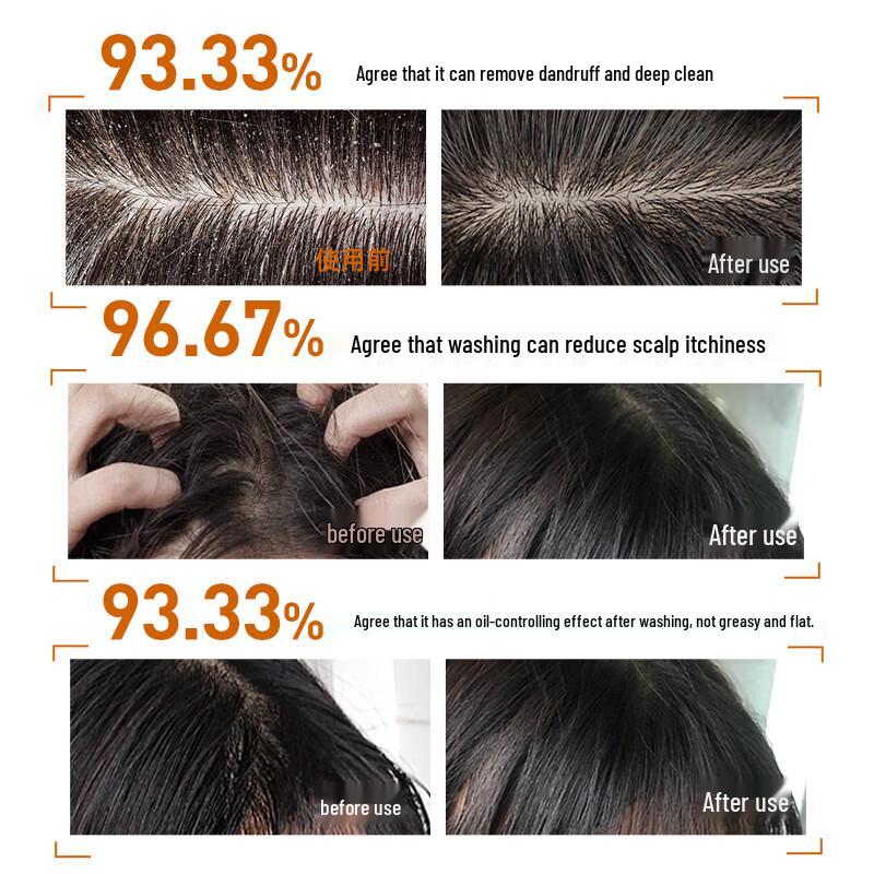 Cai Le Selenium Disulfide Anti-Dandruff Shampoo