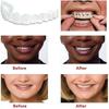 Upper & Lower Teeth Veneers - 2 Pairs Simulation Braces Sp On Veneers Smile Fake Teeth Cover Imperfect Teeth Perfect Whitening False Teeth One Size De