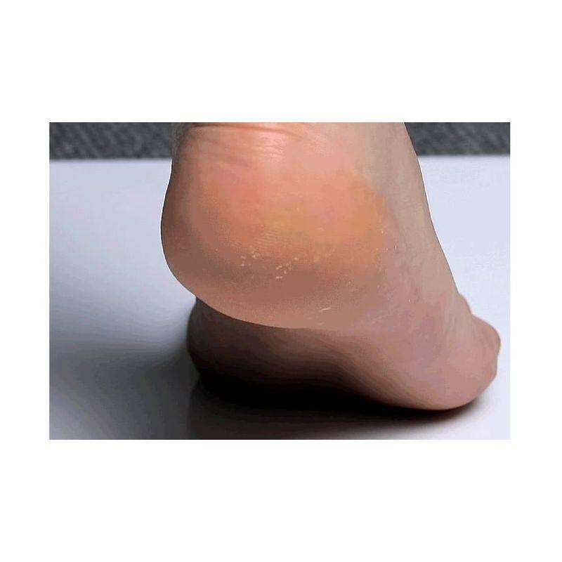 MEDIPEEL - EGF Scaling Moisture Foot Cream