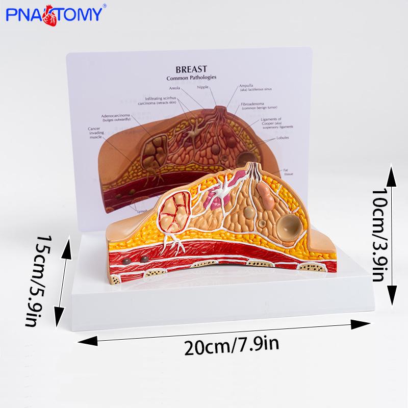 Breast Pathology Teaching Model for Gynecological Education - PNT-0741 PNT-0741