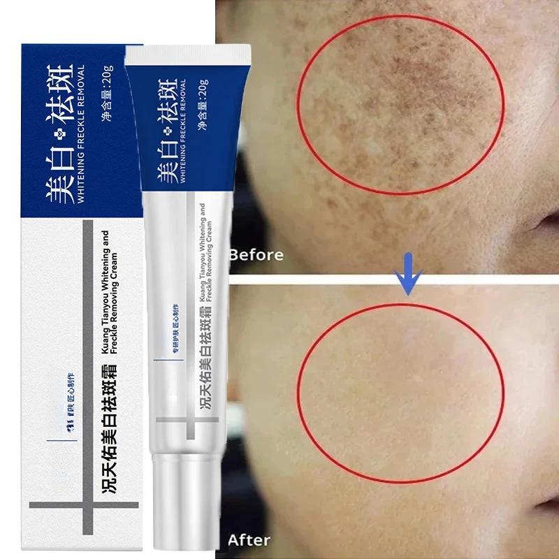 Crème blanchissante efficace pour les taches de rousseur, élimine le mélasma, atténue les taches brunes, hydrate, éclaircit la peau du visage, produit de soin