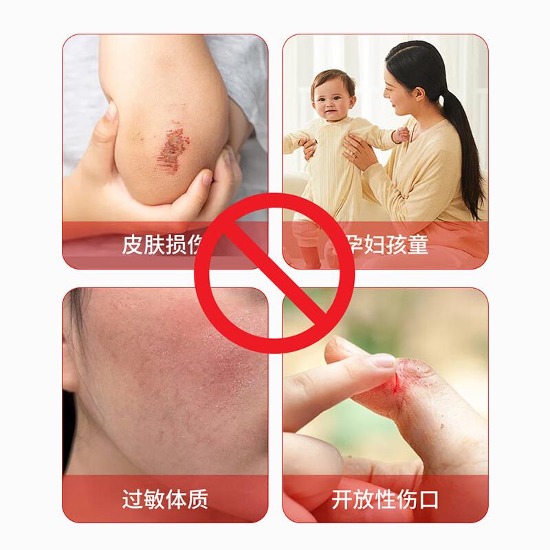 55g Thai Hemorrhoid Ointment (External) - Reduces Irritation, Eases Discomfort, Upgraded Formula