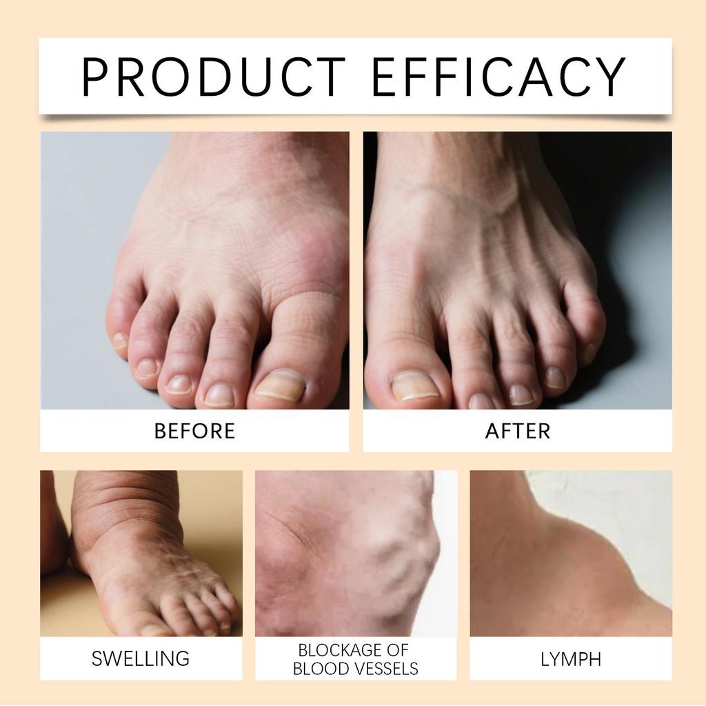 24pc Lymphatic Care Patch Swelling Care Body Discomfort Relief, Armpit And Neck Knot Fix Patch