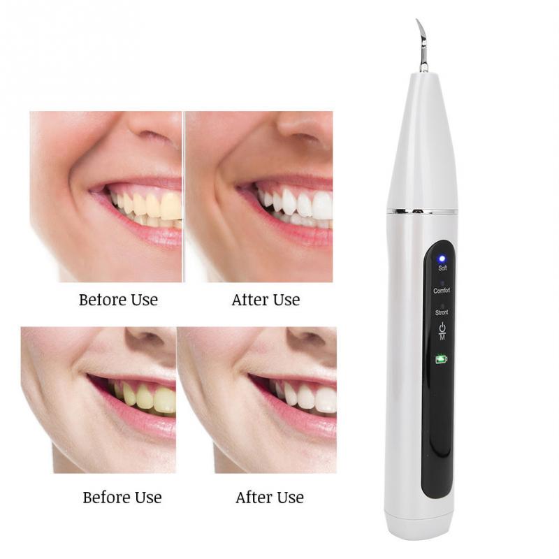 Intelligent Ultrasonic Electric Dental Scaler Dental Calculus Plaque
