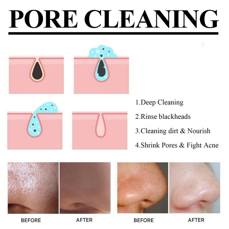 Eelhoe Blackhead Removal Pore Minimizing Mask For Deep Cleansing And Smooth Skin