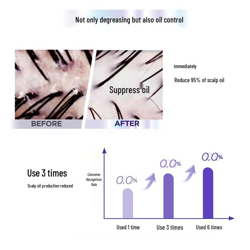 Dihua Zhixiu Hyaluronic Acid Oil Control Anti-Dandruff Shampoo