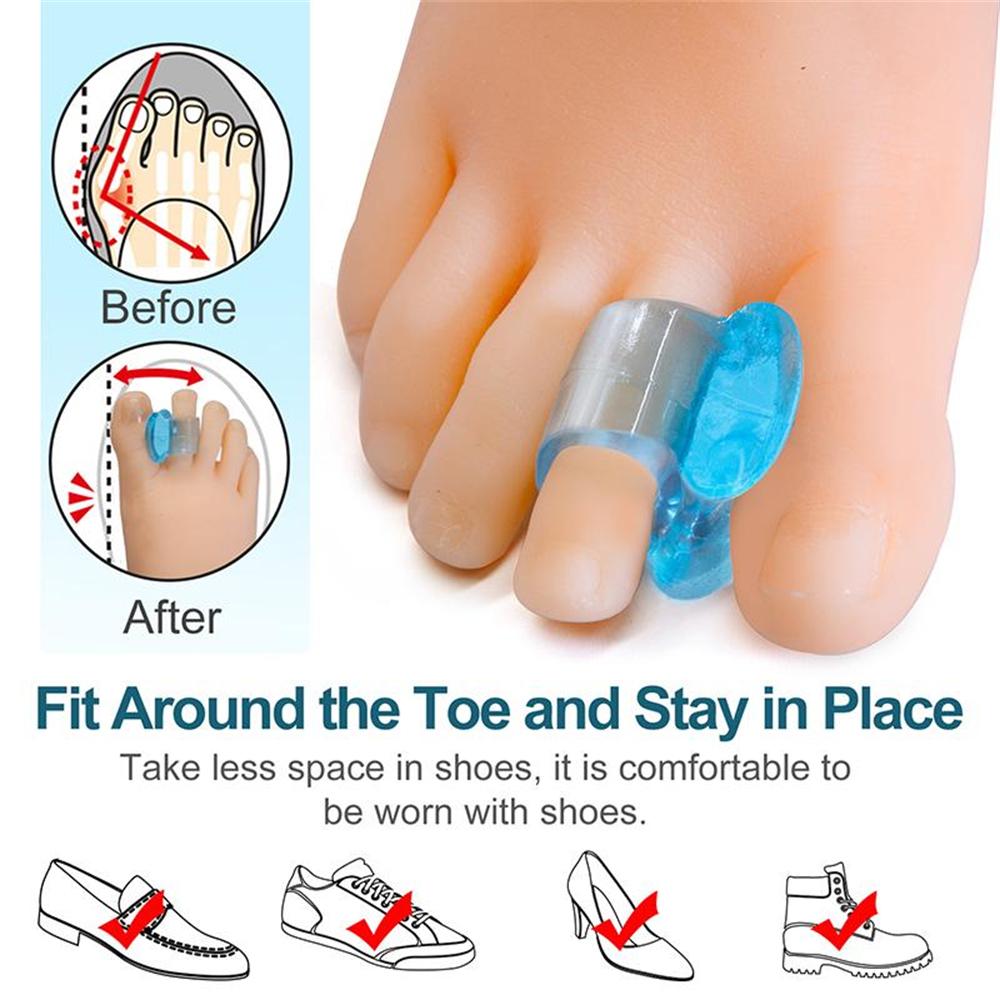 6 Paar Zehentrenner für überlappende Zehen Gel-Hammerzehenstrecker und Ballenzeh-Entlastungspads Silikon-Großzehenspreizer zur Hallux-Valgus-Korrektur