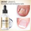 Nail Care Oil - Moisturizes, Smooths & Adds Shine 30ml