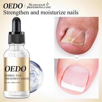 Nail Care Oil - Moisturizes, Smooths & Adds Shine 30ml