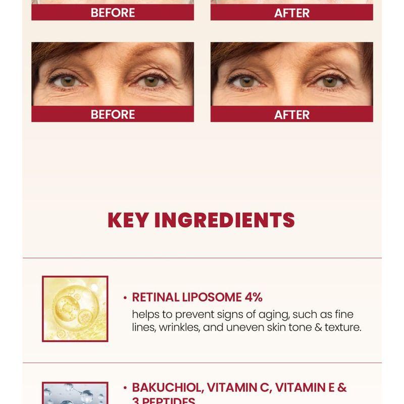 KSECRET SEOUL 1988 Eye Cream : Retinal Liposome 4% + Fermented Bean