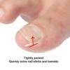 50pcs  Set Ingrown Nail Pad Embedded Toe Nail Correction Pads Nail Artifacts Orthopedic Man Woman Professional Foot Care Tool Szkyd