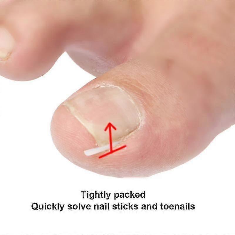 50pcs  Set Ingrown Nail Pad Embedded Toe Nail Correction Pads Nail Artifacts Orthopedic Man Woman Professional Foot Care Tool Szkyd