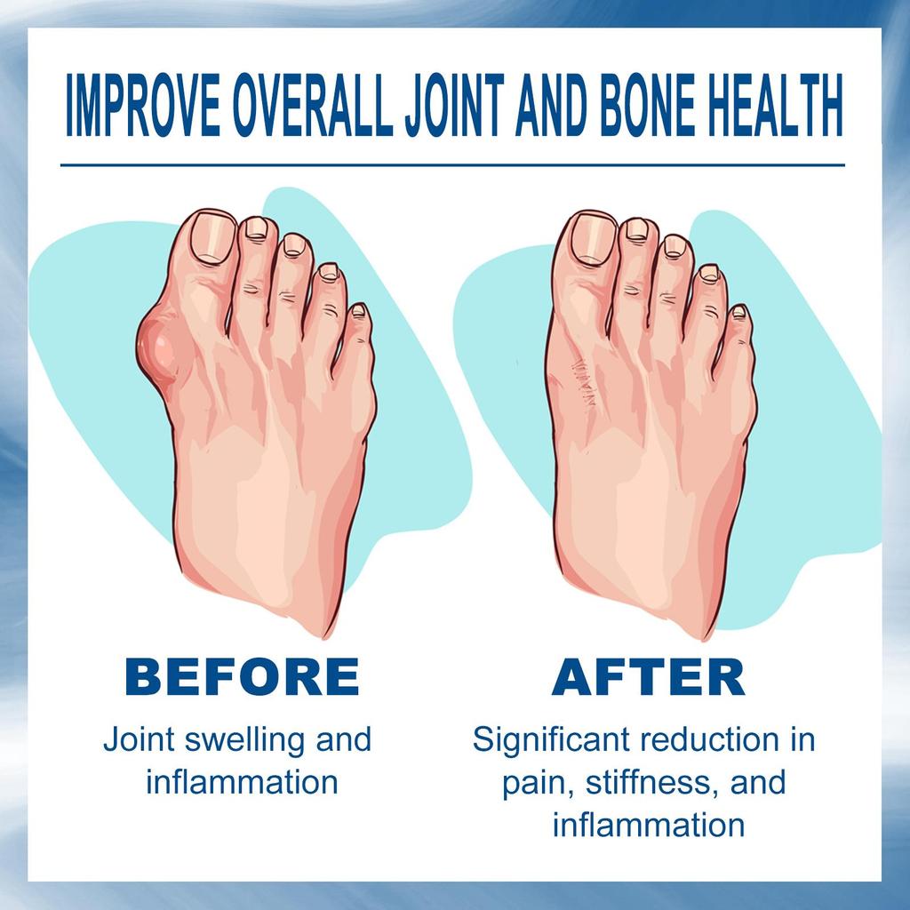 South Moon Joint Care Roll-On Liquid for Body Joints, Wrists, Knees, Lumbar and Cervical Spine Pain Relief Liquid