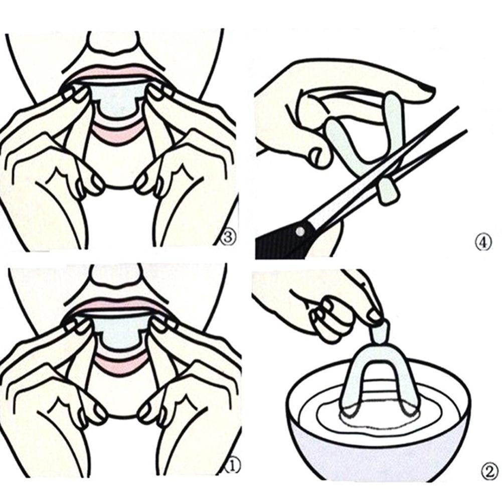 Dental Guard Night Teeth Grinding Prevention Mouthguard Gum Protection Cushion Anti-Grinding Device Comfortable Wear Oral Care