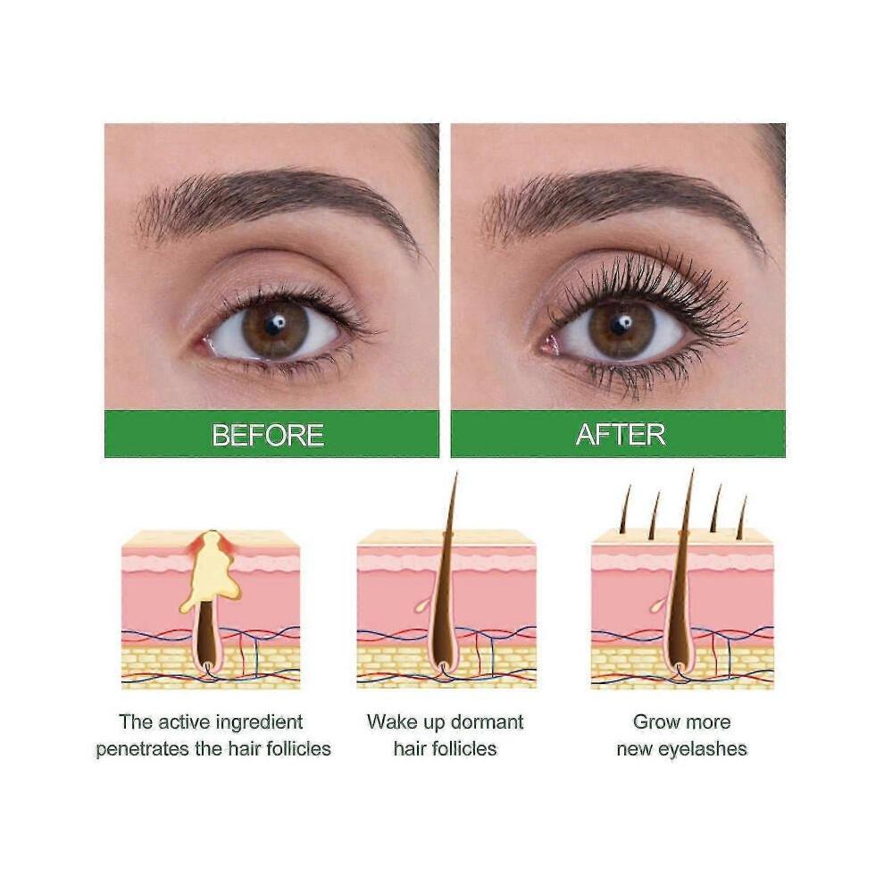 Ouhoe Castor Oil Hair Serum Improves Hairline, Strengthens Hair, Nourishes Hair Roots, Softens Hair And Prevents Hair Loss -jxlgv | |