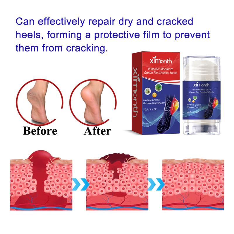 Foot Care Cream, Gentle Exfoliating, Moisturizing, Daily Foot Care Cream For Heels.