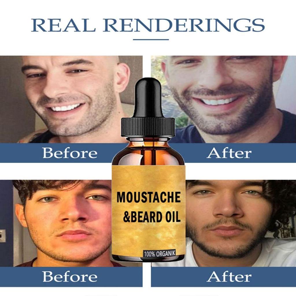 Beard Oil  Hair Growth  Beard Growth  Hair Oil for Fast Hair Growth