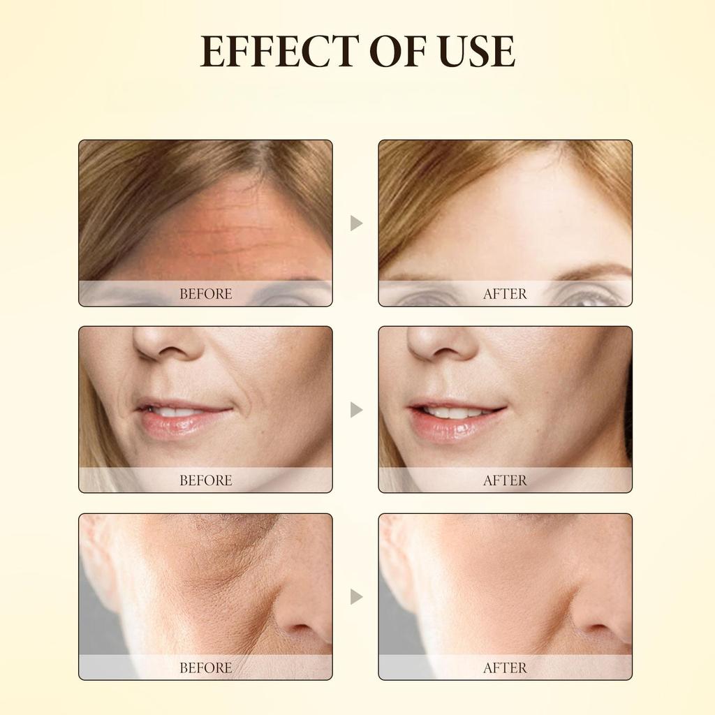 30g Bee Venom Face Care Cream Firming Cream Moisturizing Face Cream Anti-aging Soothing Treatment Nourishing Facial Repair Cream