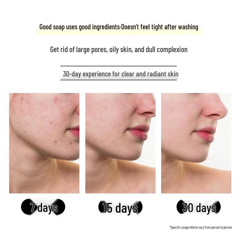 Green Valley Soft & Smooth Hydrating Shampoo Set