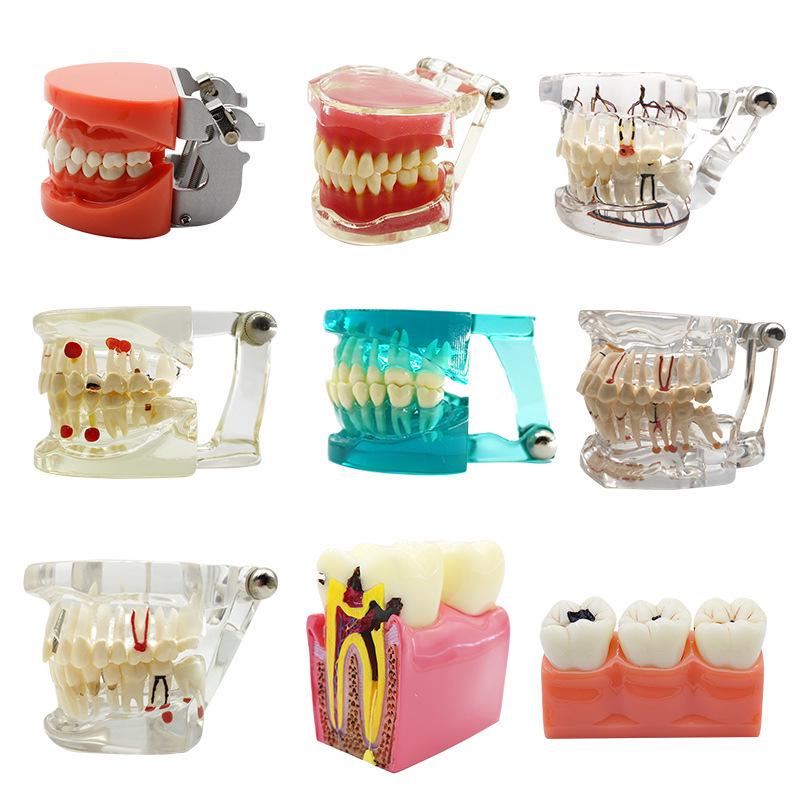 Dental Educational and Communication Model Set: Comprehensive, Removable, and Implant Restoration Models