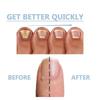 Ingrown Nail Repair Solution Safe Painless Anti-Fungal Toe Care Serum for Men & Women Nail Fungus Treatment 15ml