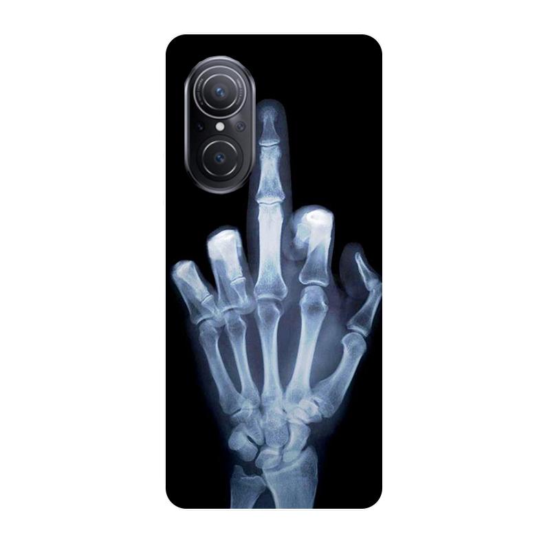 

Чехол для телефона для Huawei Nova 9 SE, чехол-бампер, мягкий силиконовый чехол для Huawei Nova 9 SE, 6,78 дюйма; Крутой мультяшный чехол для Nova9 SE 9se Nova 9 SE