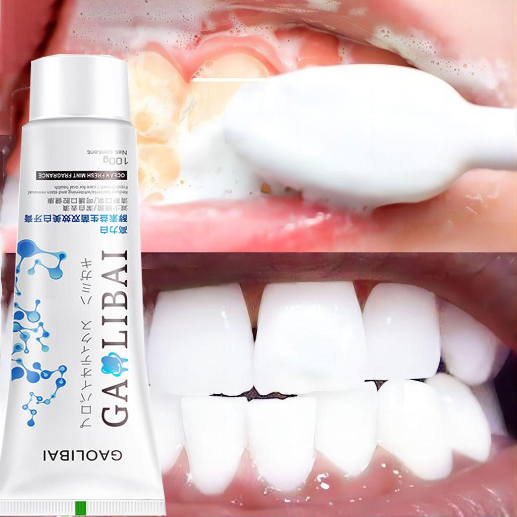 Rimozione del tartaro dentale Sbiancamento Rimozione dell'alito cattivo Dentifricio Sbiancamento Prevenzione Pulizia dentale Cura