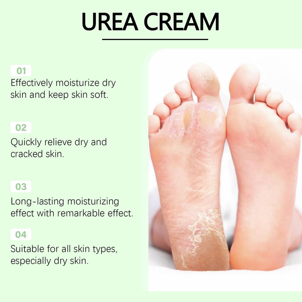 WIYUN Urea Care Cream for Hands & Feet: Hydrates, Moisturizes & Nourishes To Prevent Dryness and Cracking.