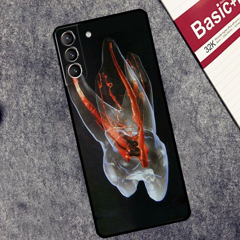 dentist tooth pattern Case For Samsung Galaxy S25 S26 Ultra S20 S21 S22 S23 S10 Plus S25 FE S24 Ultra Cover Coque