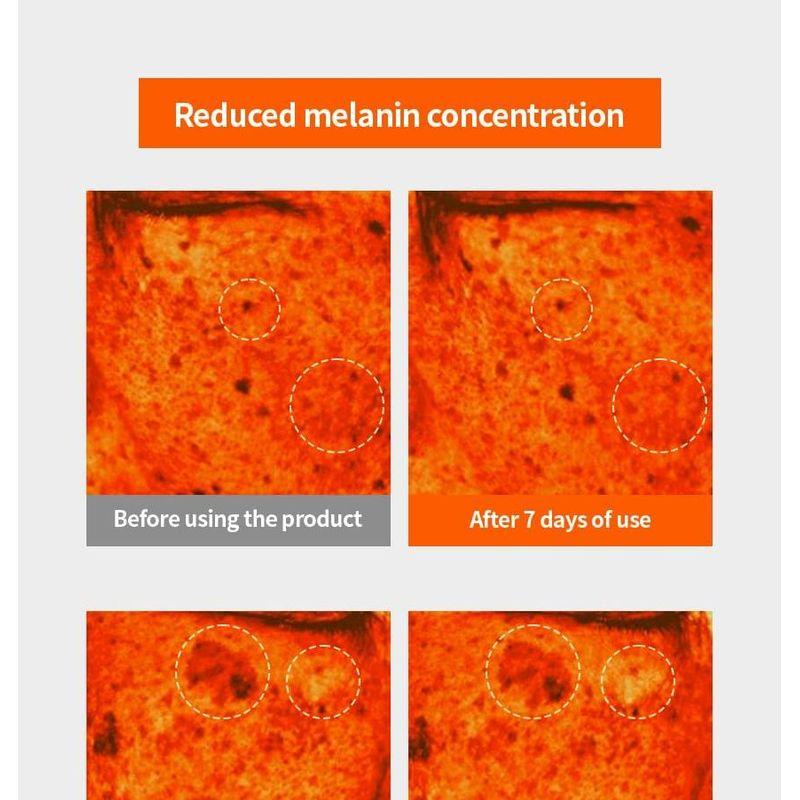 Fraijour - Yuzu Honey Anti-Mela Capsule Mask