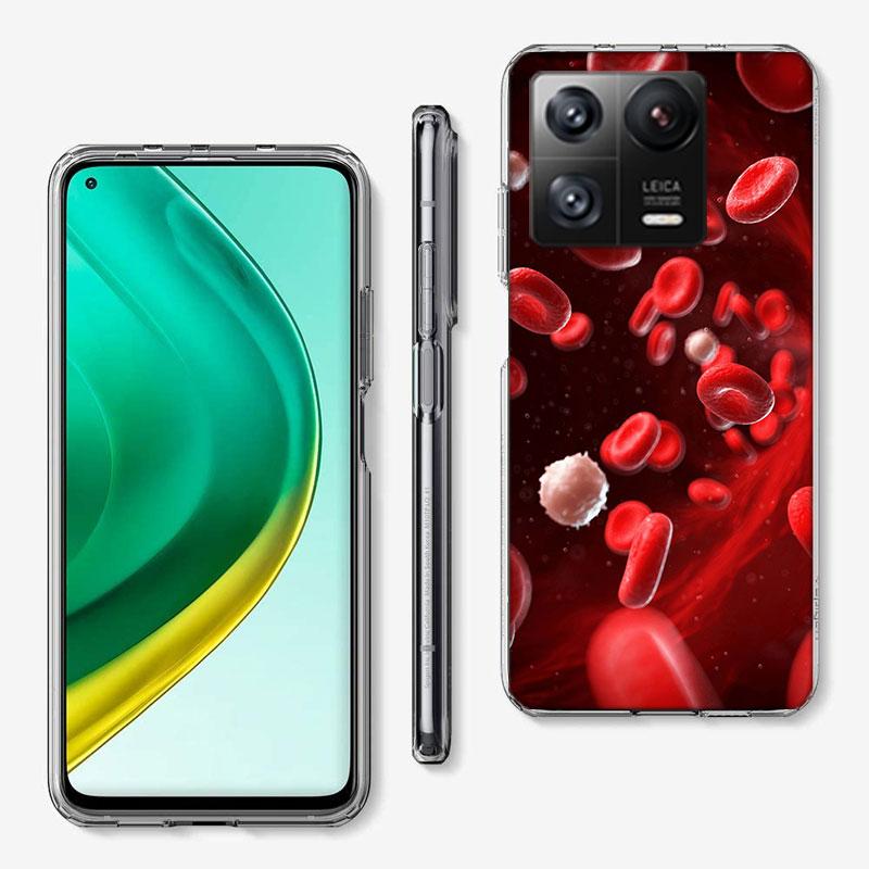 Blood Platelets Under Microscope Phone Case For Xiaomi Poco F7 Ultra X7 X6 M8 M7 M6 M4 M3 Pro X4 Mi 15 15T 14 14T 12T 12S 10T Pr