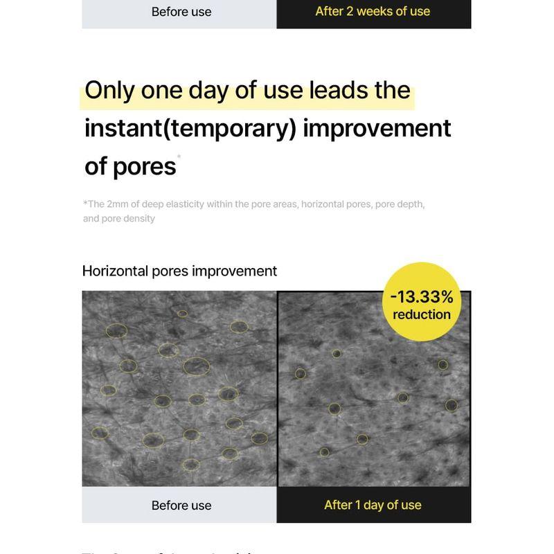 celimax - JIWOOGAE Heartleaf BHA Peeling Pad