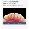 TOSOWOONG SOS Teeth Whitening Glow Clinic Glow White Toothpaste