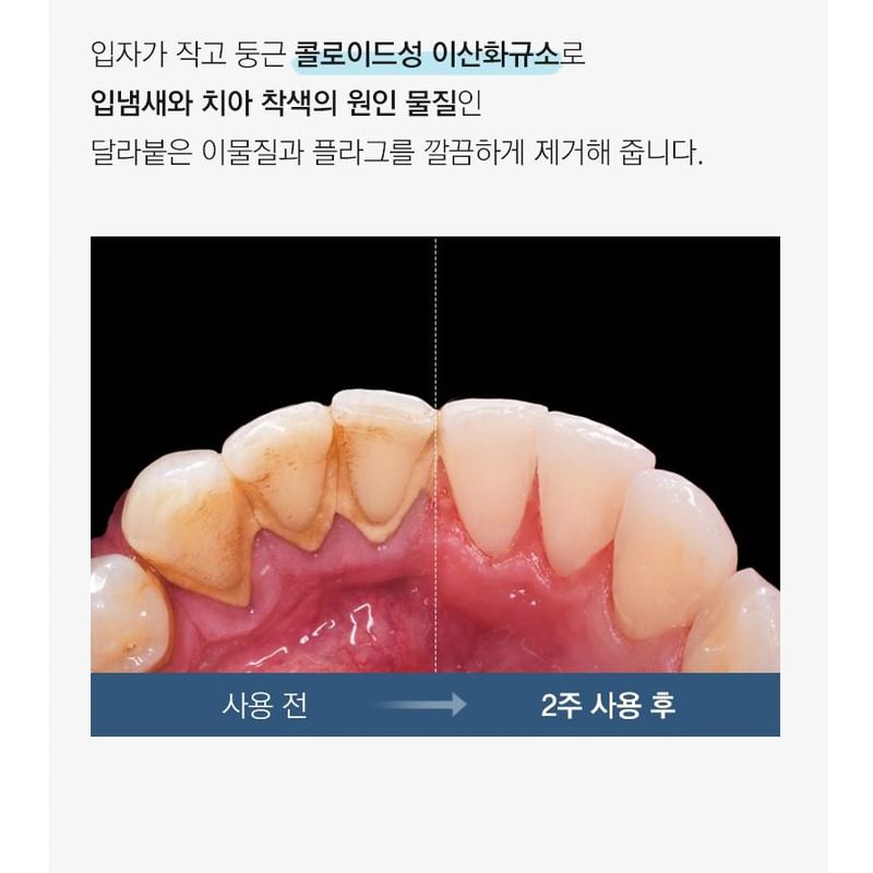 TOSOWOONG SOS Teeth Whitening Glow Clinic Glow White Toothpaste