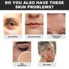 Eelhoe Collagen Water Soluble Face Cheek Patches For Wrinkle Reduction And Hydration