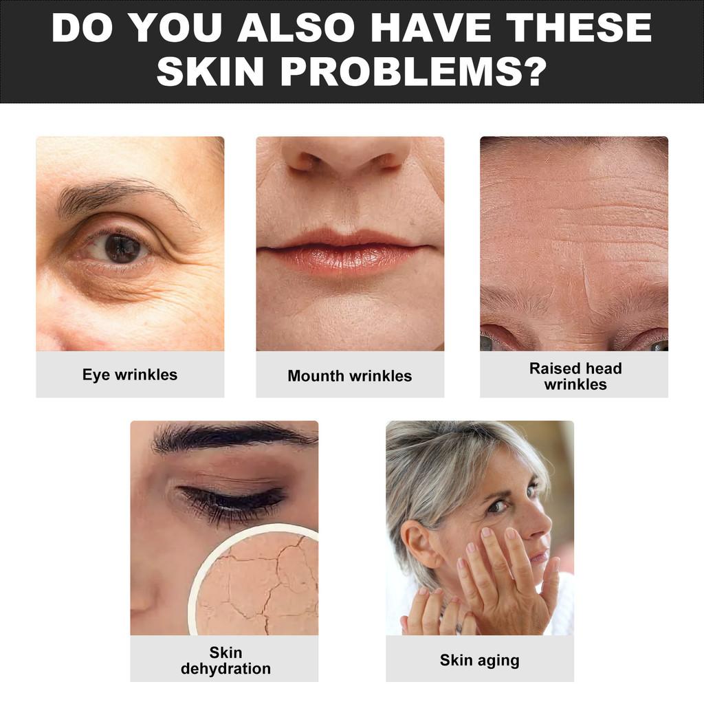 Eelhoe Collagen Water Soluble Face Cheek Patches For Wrinkle Reduction And Hydration