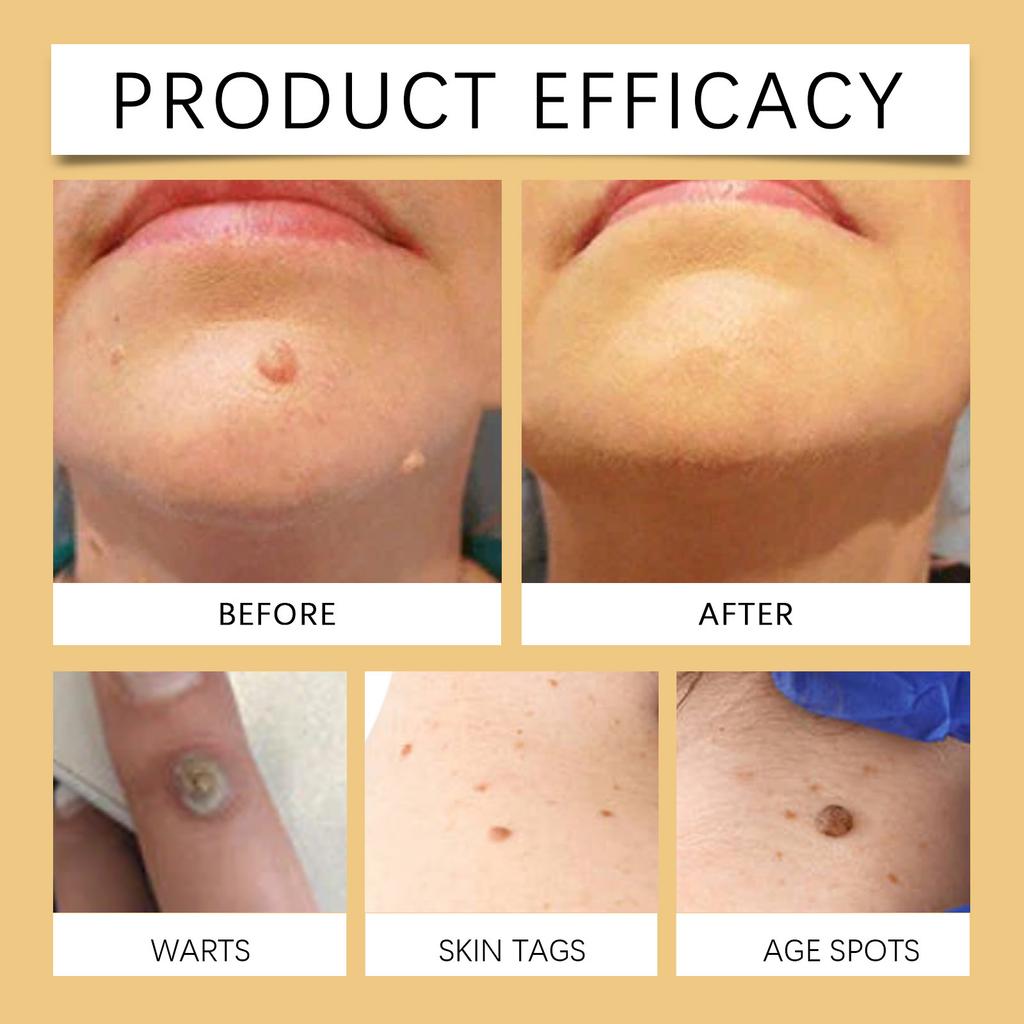 Cremă de îngrijire a pielii cu venin de albine, hidratantă delicată pentru corp, imperfecțiuni, cremă netezitoare pentru îngrijirea pielii corpului