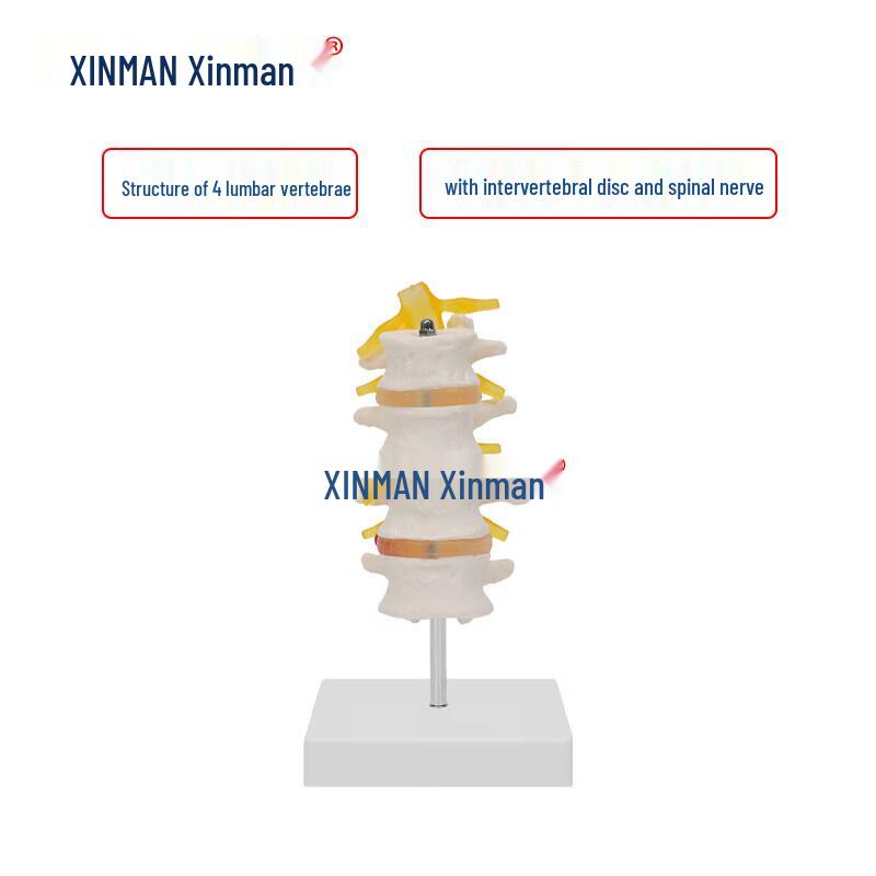 XINMAN 4-Section Lumbar Spine Model