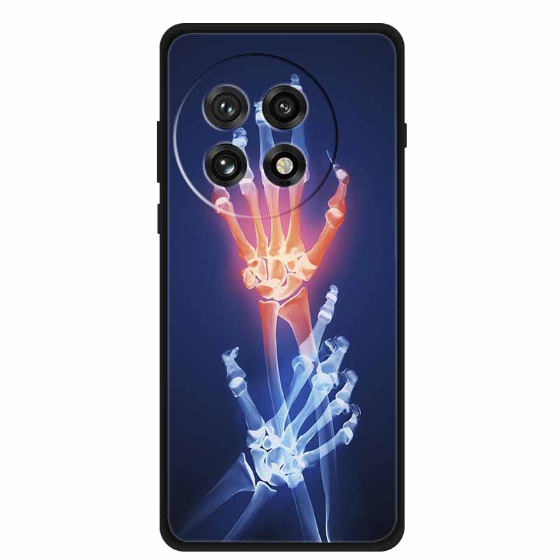 For OnePlus Ace 5 5G Phone Case Wolf Soft Black Silicone Case For OnePlus 13 5G Ace 5 Ace5 Pro 13R Back Cover Case Shockproof