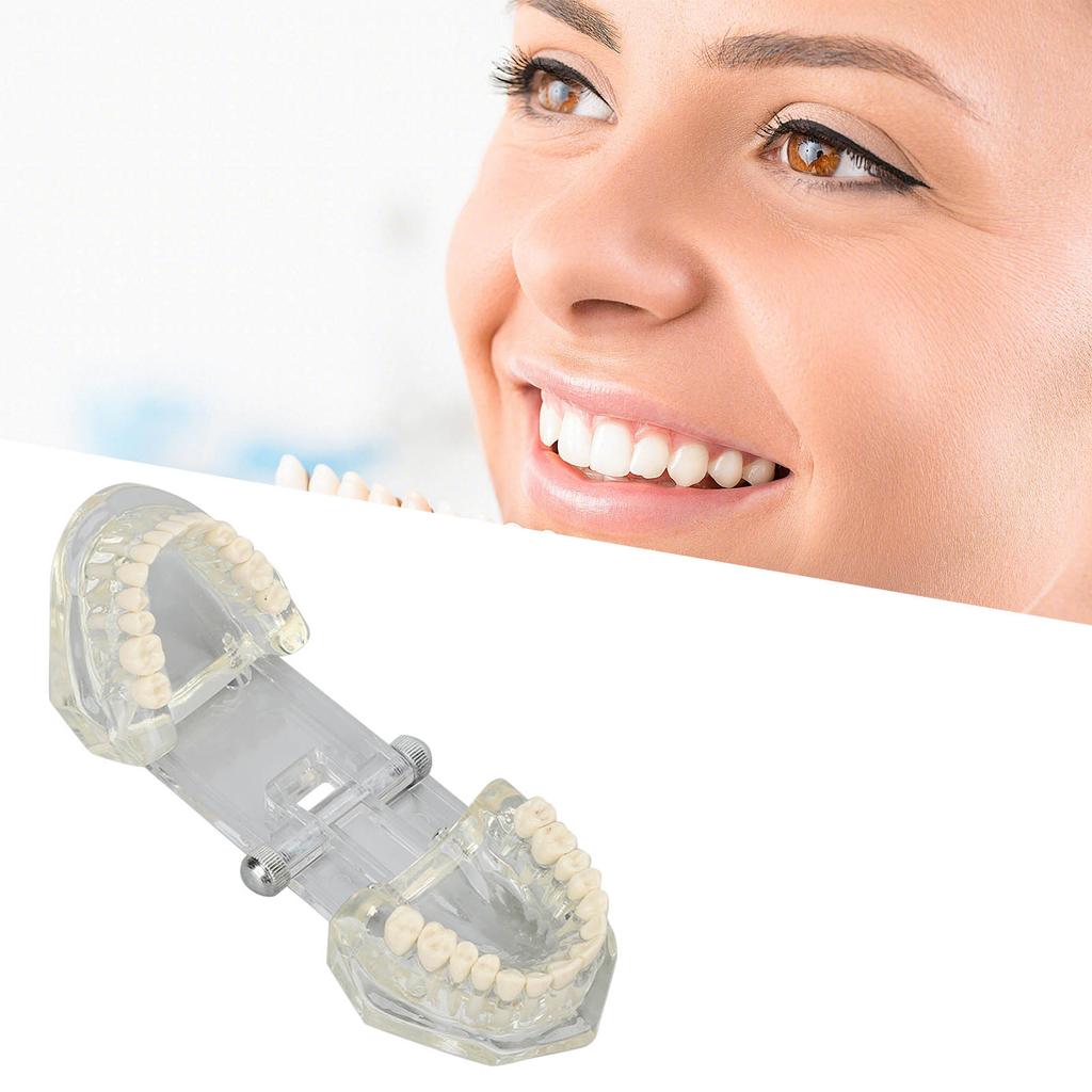Transparent Dental Model Clear Structure Educational Dental Teeth Display Model for Dental Clinic