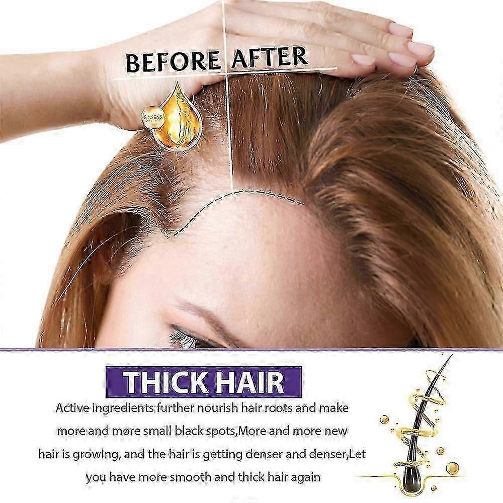 Traitement Pousse des Cheveux Extra Force 2% pour Femmes - Solution Topique au Minoxidil pour Combattre la Chute des Cheveux & Stimuler la Nouvelle Pousse