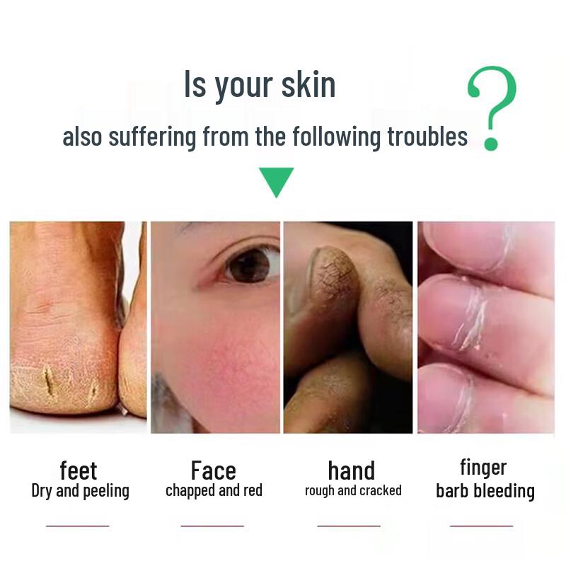 Qicao Liqing Hand & Foot Crack Repair Cream