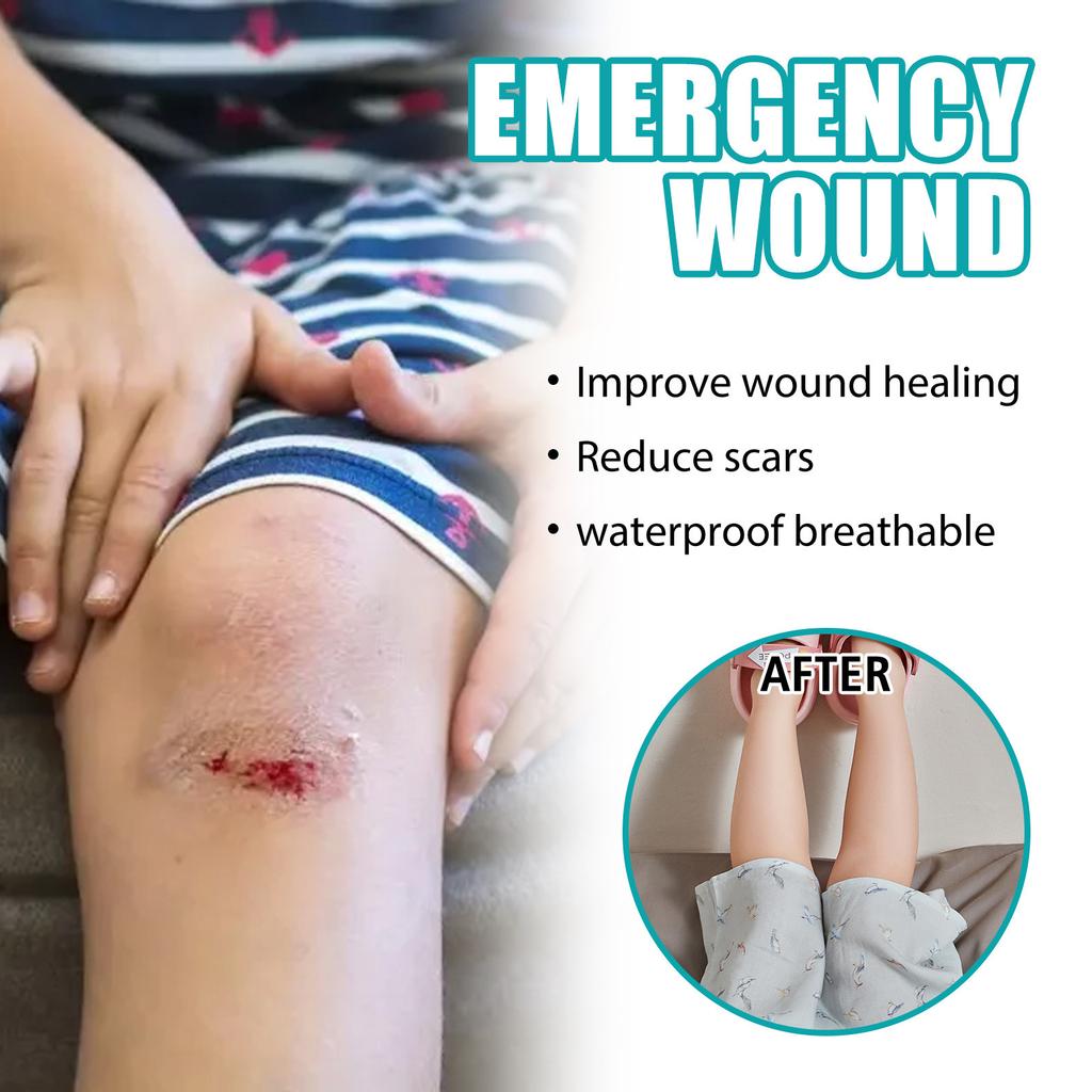 Wound Relief Gel, Liquid Wound Suture Glue, Isolate And Keep Dry 10ml