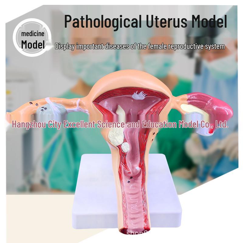 Female Reproductive System Model: Uterus, Ovary & Vaginal Anatomy for Gynecology Education PVC Material