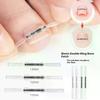 Ingrown Toenail Corrector Tools Pedicure Recover Embed Toe Nail Treatment Professional Ingrown Toenail Straightening Clip Brace