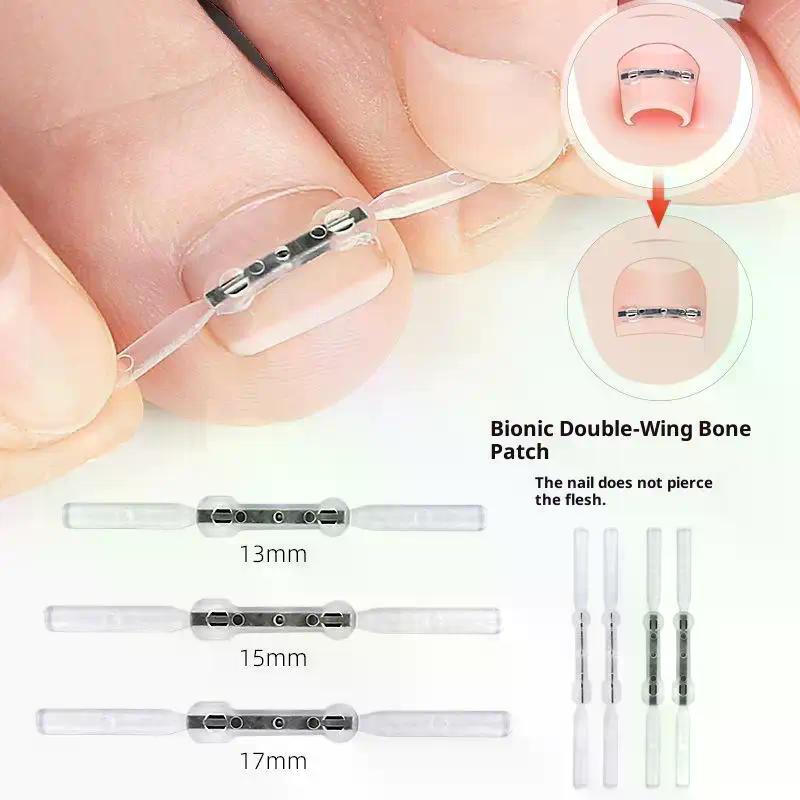 Ingrown Toenail Corrector Tools Pedicure Recover Embed Toe Nail Treatment Professional Ingrown Toenail Straightening Clip Brace