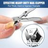 GJNL Nail Clippers for Men Thick Nails 2024 Upgrade Wide Jaw Opening Catcher No Splash Nail Clippers for Seniors Professional Ultra Sharp Nail Cutter